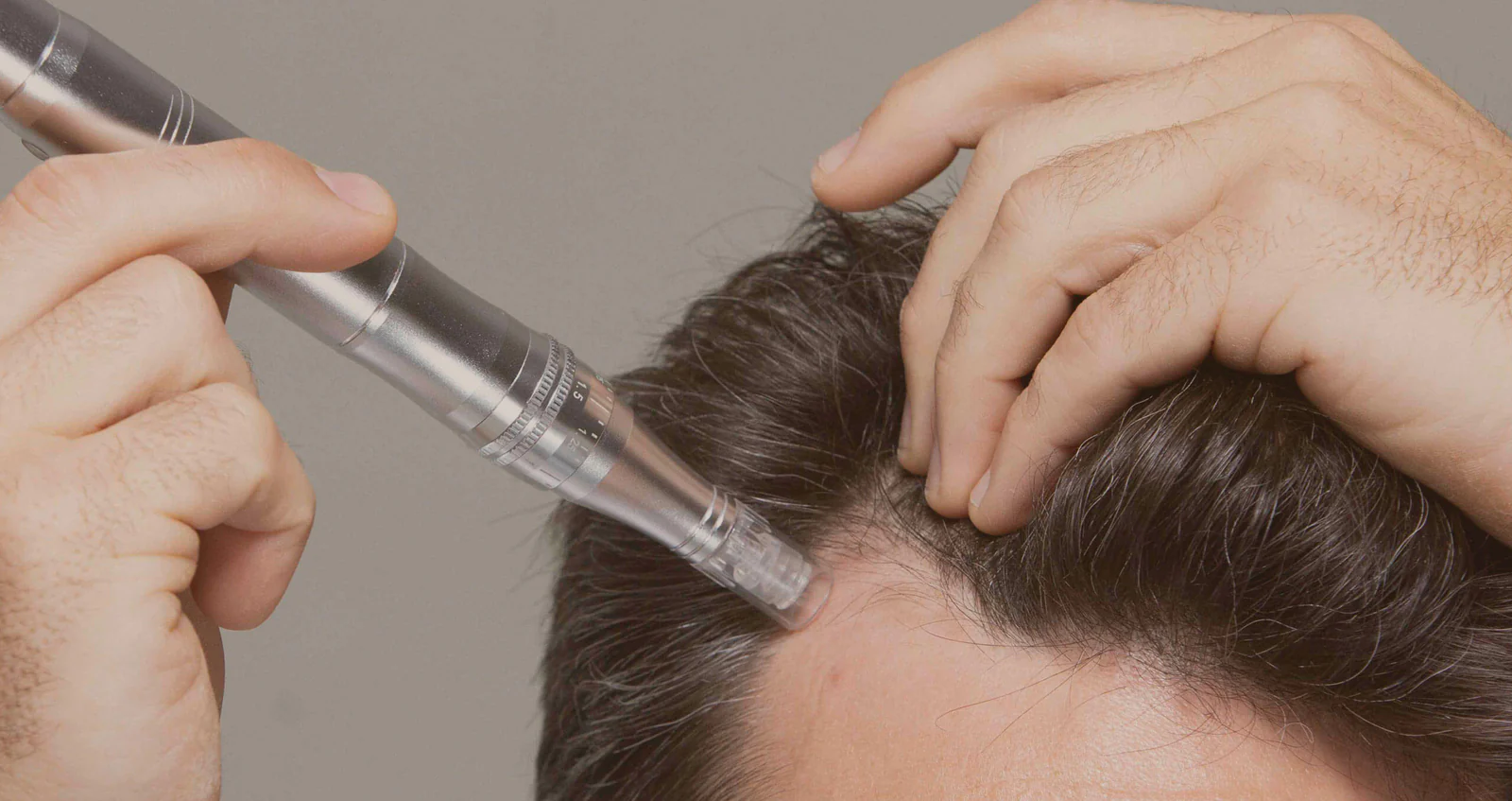 dr. pen hair growth microneedling